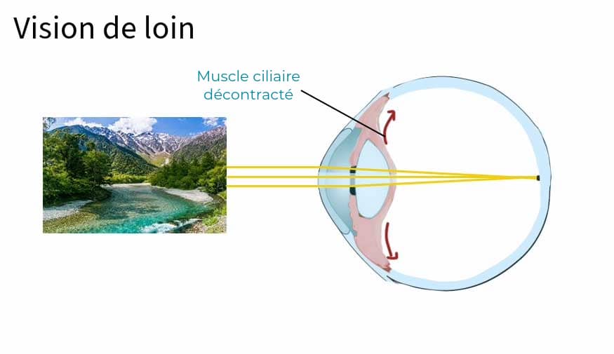 illustration d'un oeil en bonne santé vision de loin