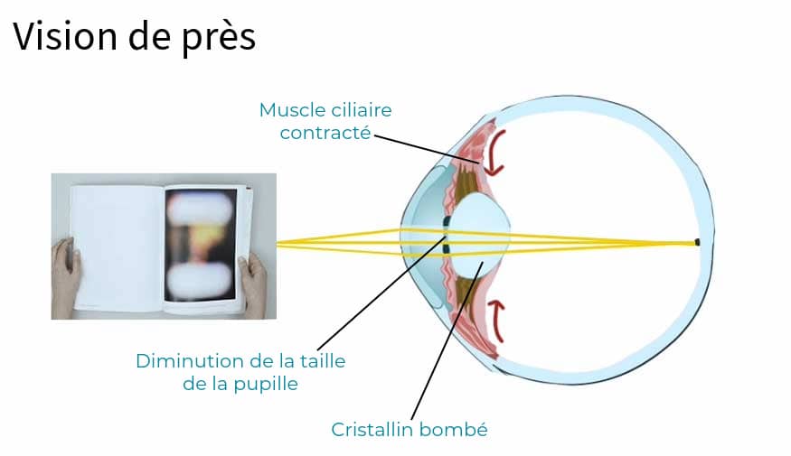 illustration d'un oeil en bonne santé vision de près