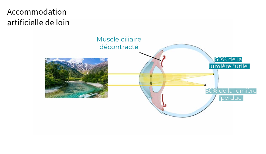 Multifocalité vision de loin presbytie