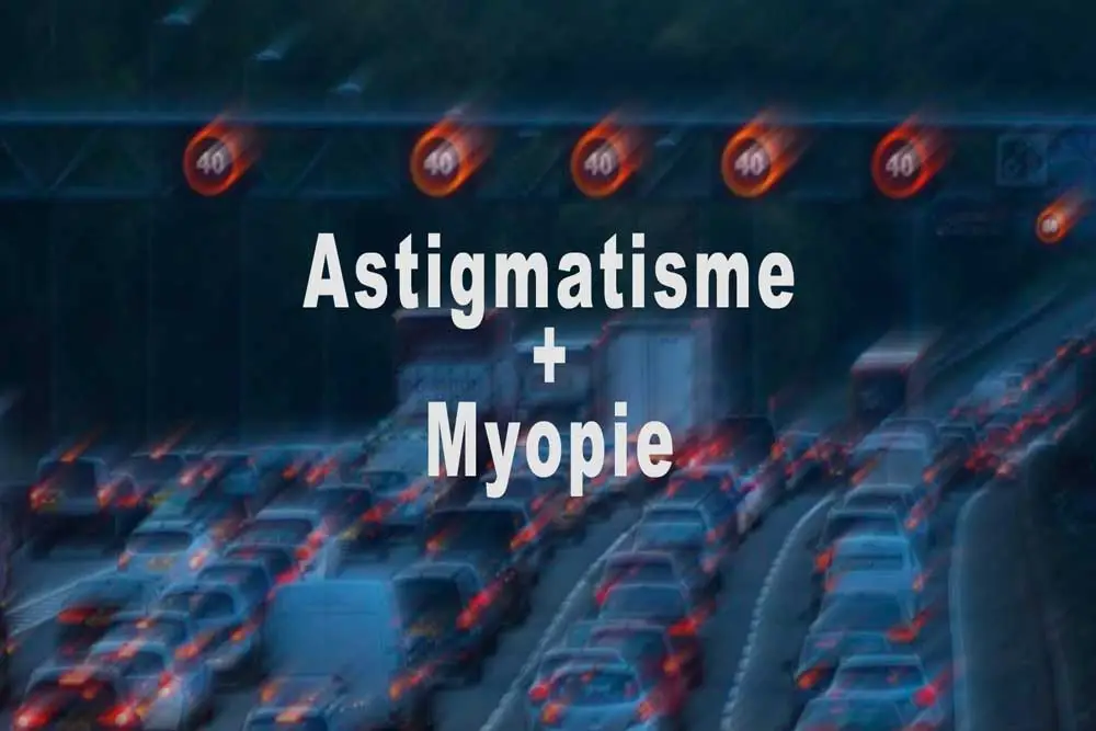 opération laser yeux myopie avec astigmatisme